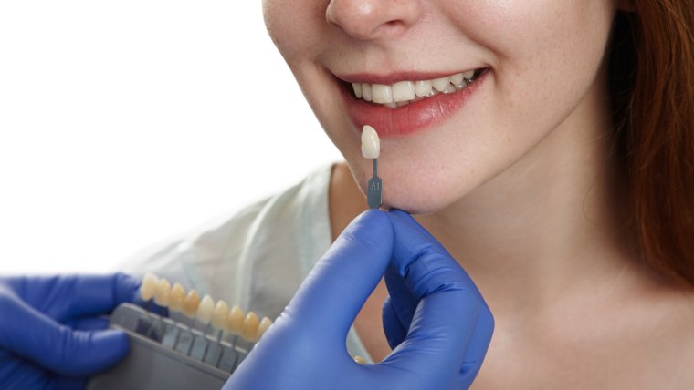 Transform Your Smile with Veneers in Bournemouth