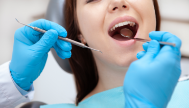 Understanding Fillings: Keeping Your Teeth Healthy at Pearl Fine Dental Care
