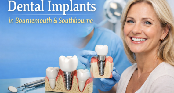 Dental Implants in Bournemouth & Southbourne (2026 Guide)