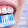 Why Your Gums Bleed When You Brush (And When to See a Dentist in Southbourne)