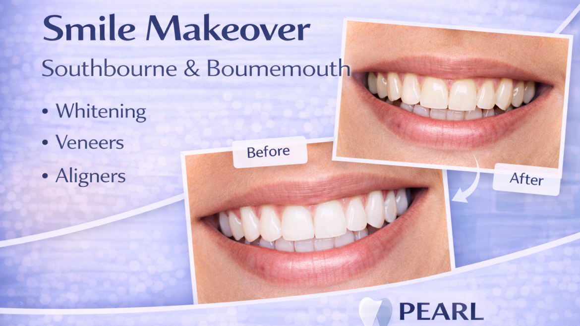 How Can a Smile Makeover Improve Your Smile?