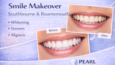 How Can a Smile Makeover Improve Your Smile?