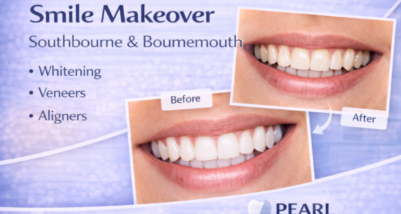 How Can a Smile Makeover Improve Your Smile?