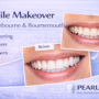 How Can a Smile Makeover Improve Your Smile?